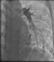 Multidiscip Cardio Annal